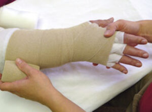 Lymphedema Hand Therapy