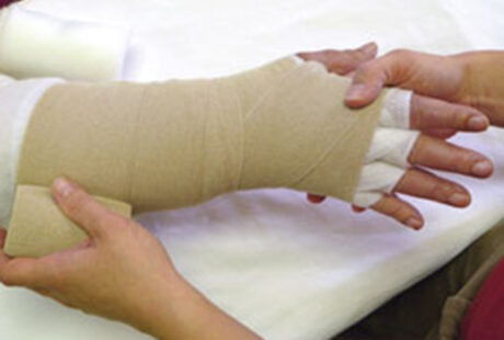 Lymphedema Hand Therapy